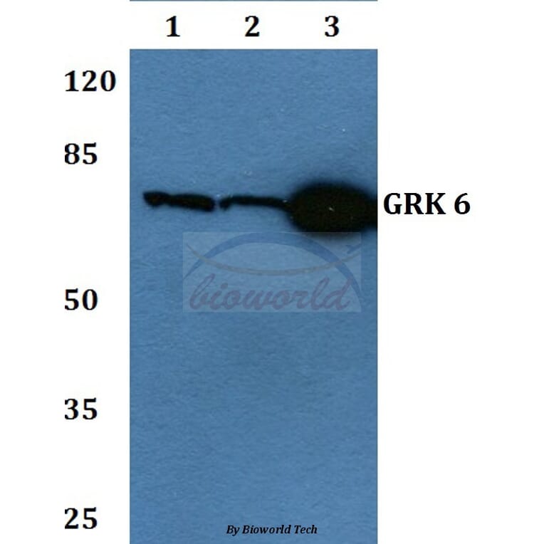 Anti-GRK 6 (N22) Antibody from Bioworld Technology (BS1997) - Antibodies.com