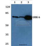 Anti-GRK 6 (N22) Antibody from Bioworld Technology (BS1997) - Antibodies.com