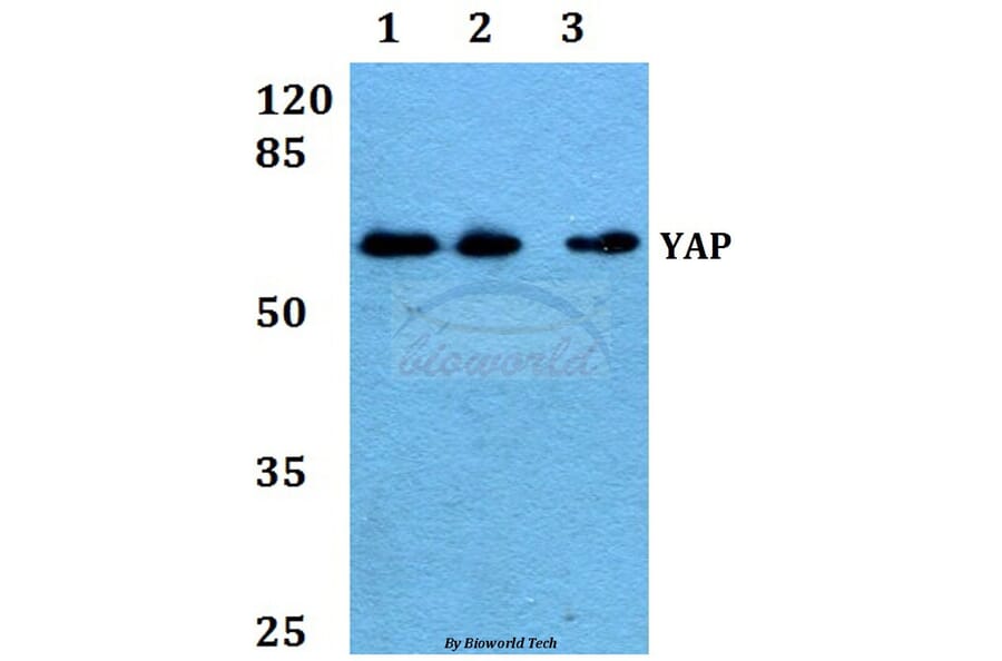 Anti-YAP (Q295) Antibody from Bioworld Technology (BS2000) - Antibodies.com