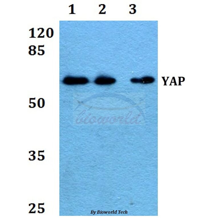 Anti-YAP (Q295) Antibody from Bioworld Technology (BS2000) - Antibodies.com