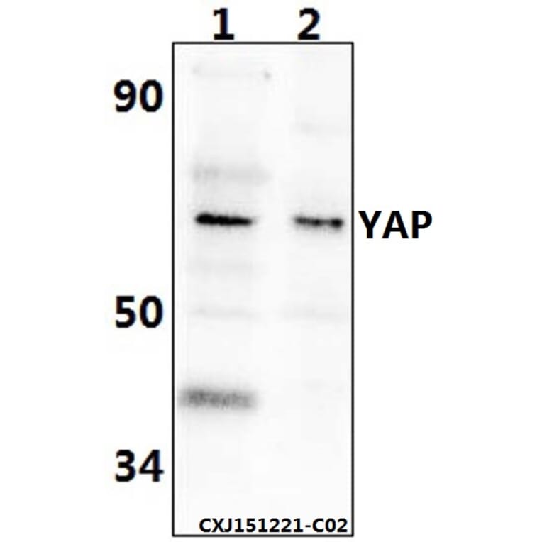 Anti-YAP (Q295) Antibody from Bioworld Technology (BS2000) - Antibodies.com