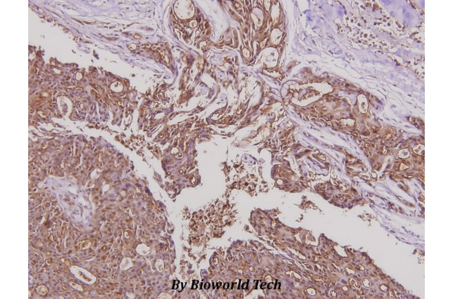 Anti-YAP (Q295) Antibody from Bioworld Technology (BS2000) - Antibodies.com
