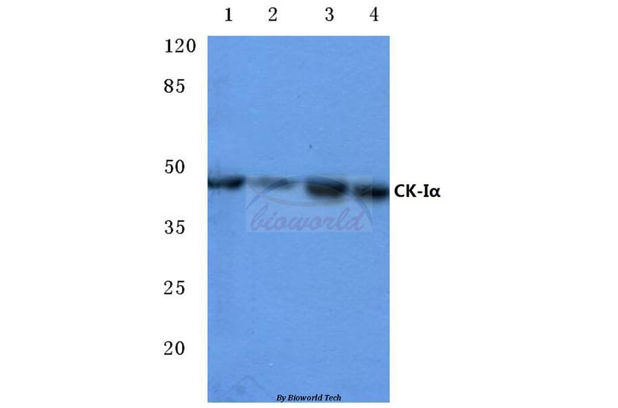 Anti-Casein Kinase Iα (F158) Antibody from Bioworld Technology (BS2001) - Antibodies.com