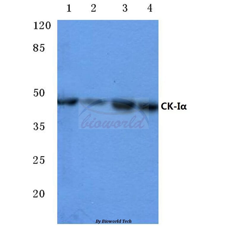 Anti-Casein Kinase Iα (F158) Antibody from Bioworld Technology (BS2001) - Antibodies.com