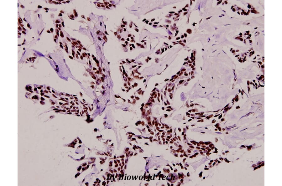 Anti-Casein Kinase Iα (F158) Antibody from Bioworld Technology (BS2001) - Antibodies.com