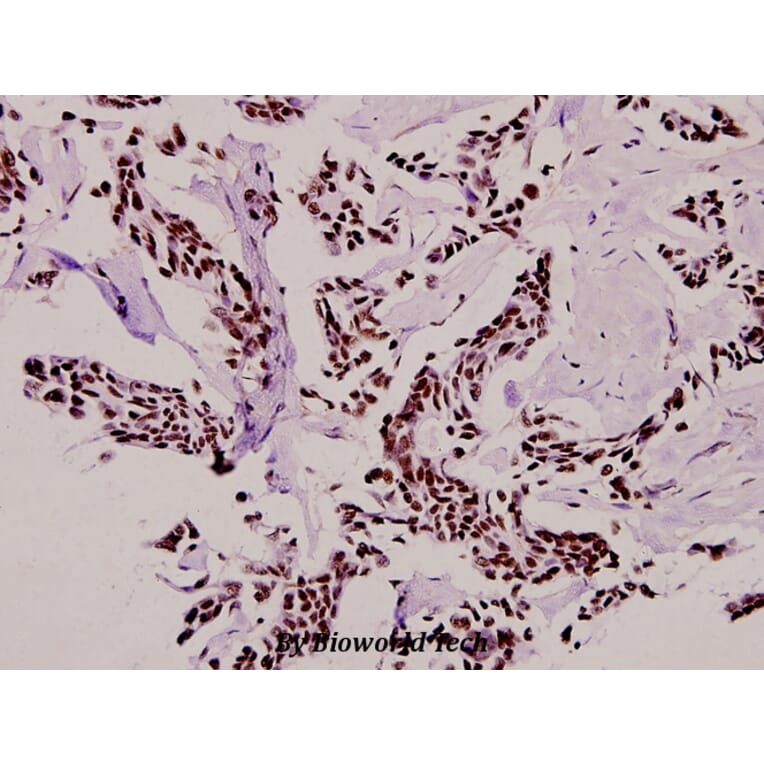 Anti-Casein Kinase Iα (F158) Antibody from Bioworld Technology (BS2001) - Antibodies.com