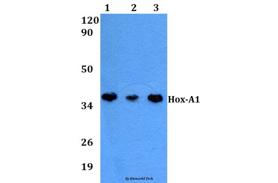 Anti-Hox-A1 (Q203) Antibody from Bioworld Technology (BS2003) - Antibodies.com