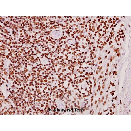 Anti-CLK2 (R15) Antibody from Bioworld Technology (BS2005) - Antibodies.com