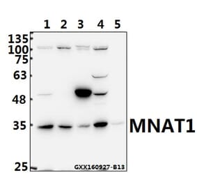 Anti-MNAT1 (E123) Antibody from Bioworld Technology (BS2011) - Antibodies.com