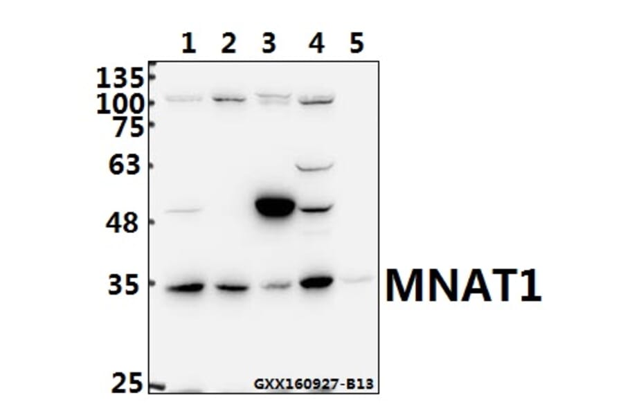 Anti-MNAT1 (E123) Antibody from Bioworld Technology (BS2011) - Antibodies.com