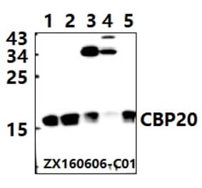 Anti-CBP20 (R21) Antibody from Bioworld Technology (BS2012) - Antibodies.com