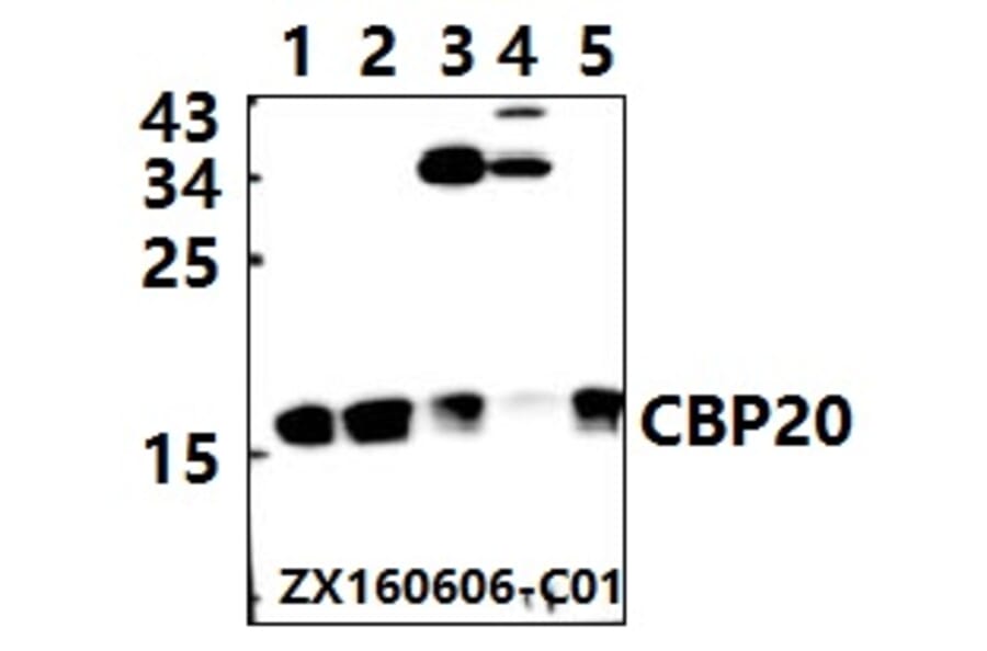 Anti-CBP20 (R21) Antibody from Bioworld Technology (BS2012) - Antibodies.com