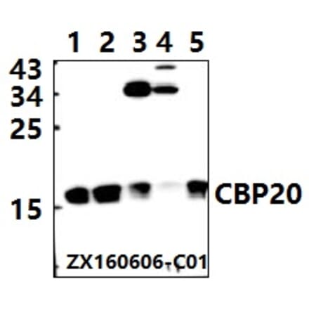 Anti-CBP20 (R21) Antibody from Bioworld Technology (BS2012) - Antibodies.com