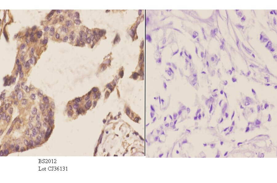 Anti-CBP20 (R21) Antibody from Bioworld Technology (BS2012) - Antibodies.com