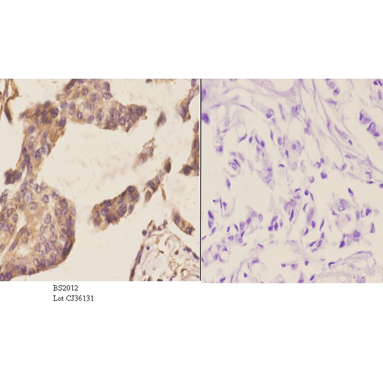 Anti-CBP20 (R21) Antibody from Bioworld Technology (BS2012) - Antibodies.com