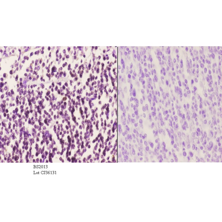 Anti-MEK-6 (Q3) Antibody from Bioworld Technology (BS2013) - Antibodies.com