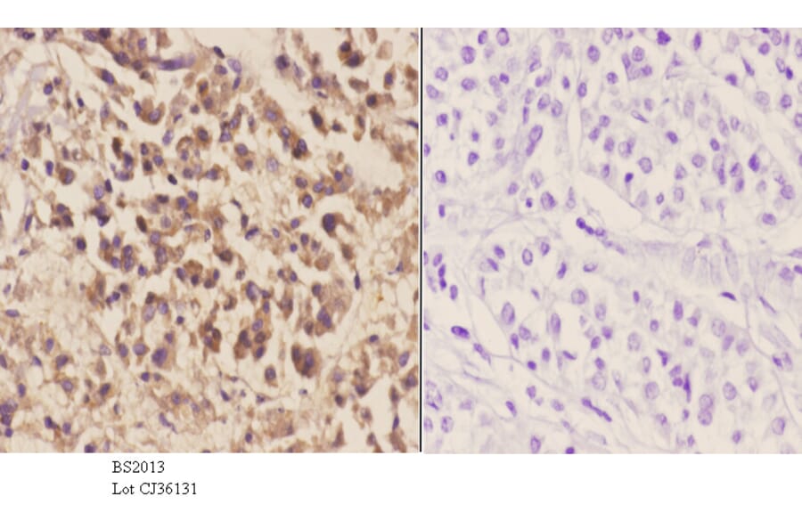 Anti-MEK-6 (Q3) Antibody from Bioworld Technology (BS2013) - Antibodies.com