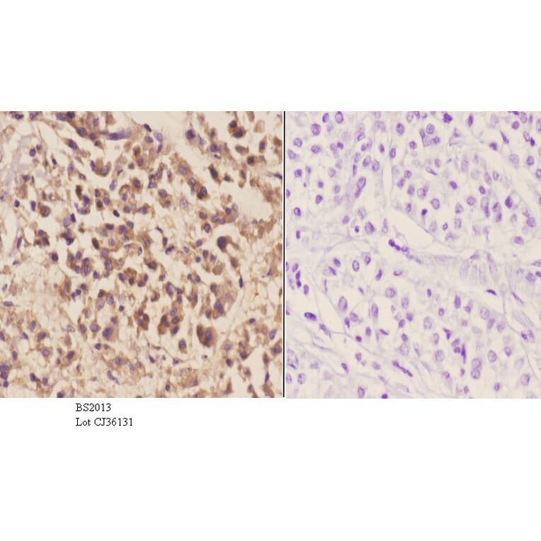 Anti-MEK-6 (Q3) Antibody from Bioworld Technology (BS2013) - Antibodies.com