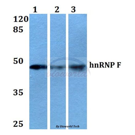 Anti-hnRNP F (Y47) Antibody from Bioworld Technology (BS2014) - Antibodies.com