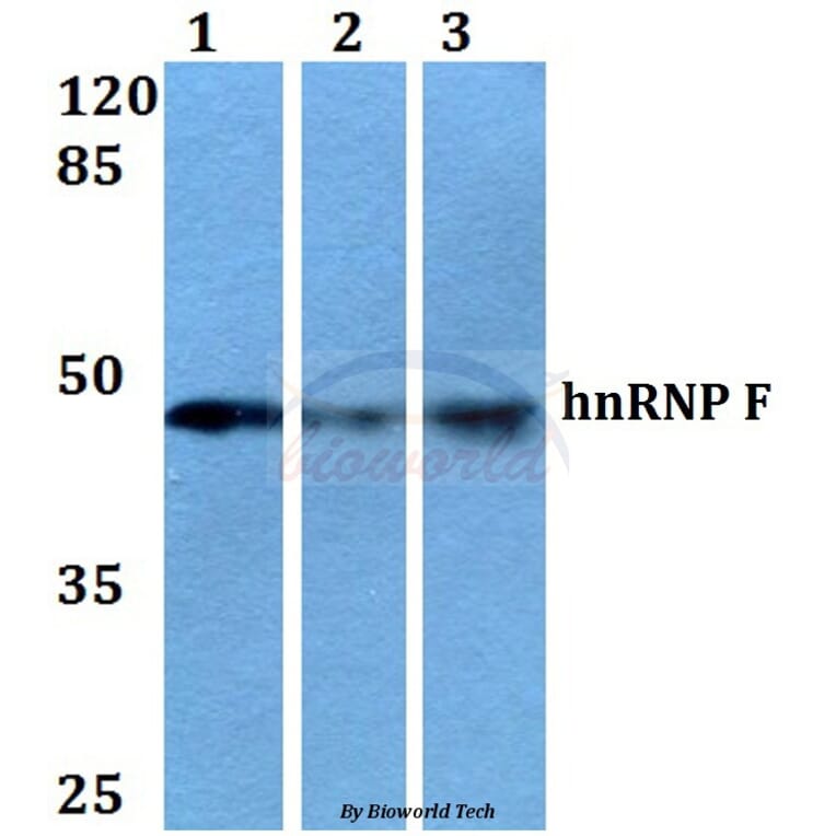 Anti-hnRNP F (Y47) Antibody from Bioworld Technology (BS2014) - Antibodies.com