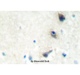 Anti-LIMK1 (Q491) Antibody from Bioworld Technology (BS2016) - Antibodies.com