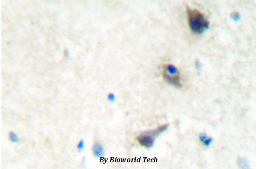 Anti-LIMK1 (Q491) Antibody from Bioworld Technology (BS2016) - Antibodies.com