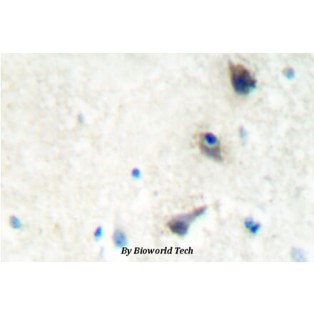 Anti-LIMK1 (Q491) Antibody from Bioworld Technology (BS2016) - Antibodies.com