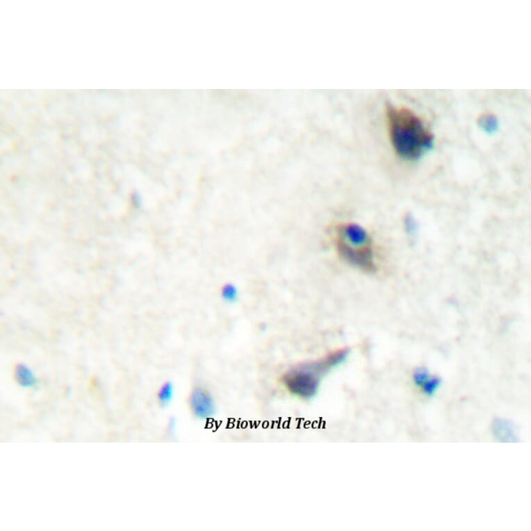 Anti-LIMK1 (Q491) Antibody from Bioworld Technology (BS2016) - Antibodies.com