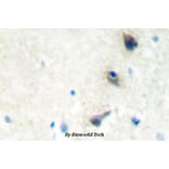 Anti-LIMK1 (Q491) Antibody from Bioworld Technology (BS2016) - Antibodies.com