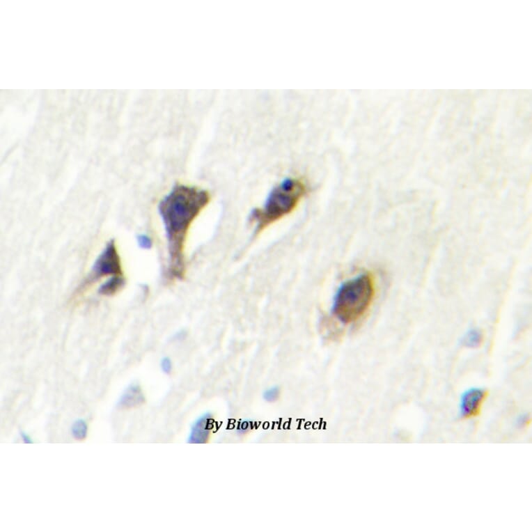 Anti-JNK3 (K391) Antibody from Bioworld Technology (BS2017) - Antibodies.com