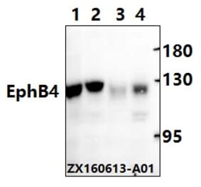 Anti-EphB4 (E601) Antibody from Bioworld Technology (BS2018) - Antibodies.com