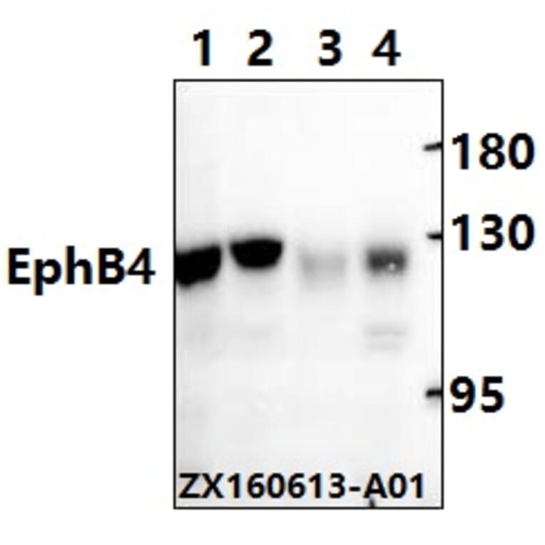 Anti-EphB4 (E601) Antibody from Bioworld Technology (BS2018) - Antibodies.com