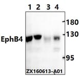 Anti-EphB4 (E601) Antibody from Bioworld Technology (BS2018) - Antibodies.com
