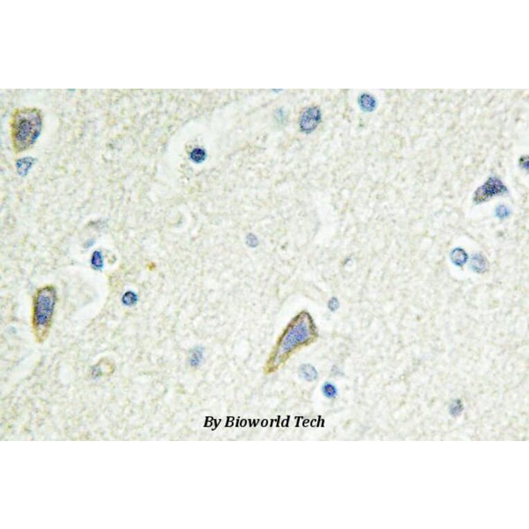 Anti-EphB4 (E601) Antibody from Bioworld Technology (BS2018) - Antibodies.com