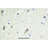 Anti-EphB4 (E601) Antibody from Bioworld Technology (BS2018) - Antibodies.com