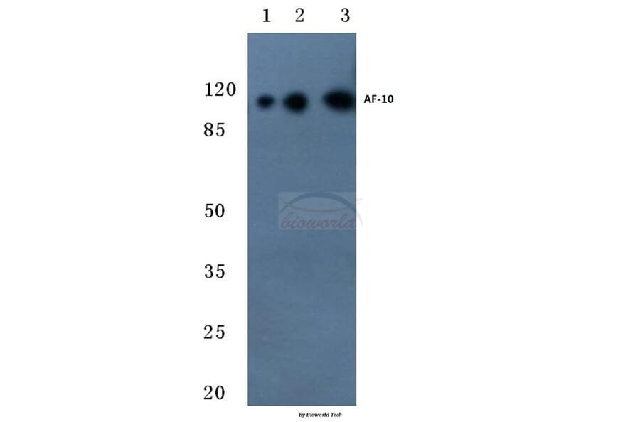 Anti-AF-10 (E237) Antibody from Bioworld Technology (BS2019) - Antibodies.com
