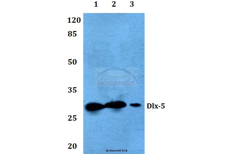 Anti-Dlx-5 (E126) Antibody from Bioworld Technology (BS2022) - Antibodies.com