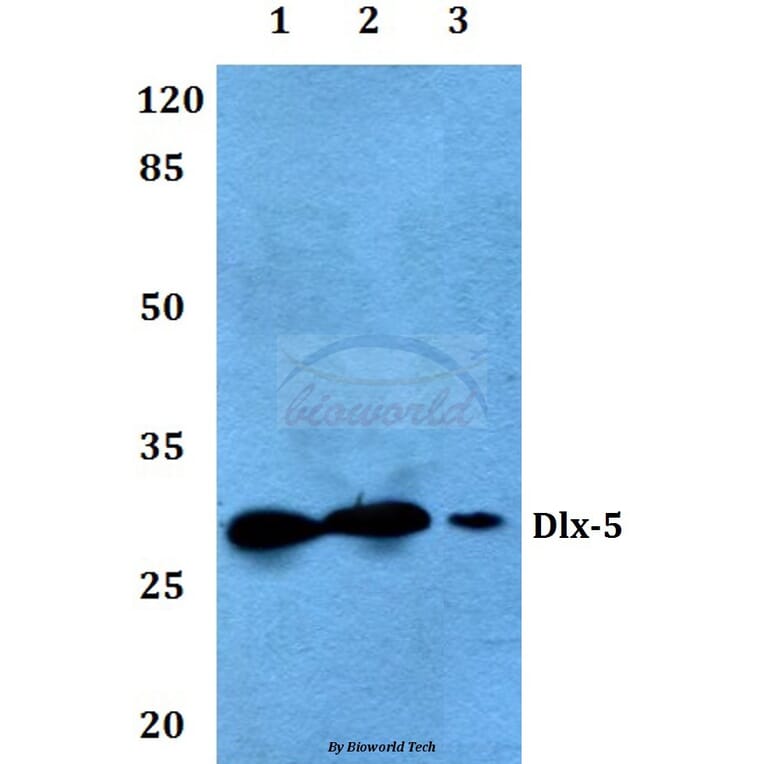 Anti-Dlx-5 (E126) Antibody from Bioworld Technology (BS2022) - Antibodies.com