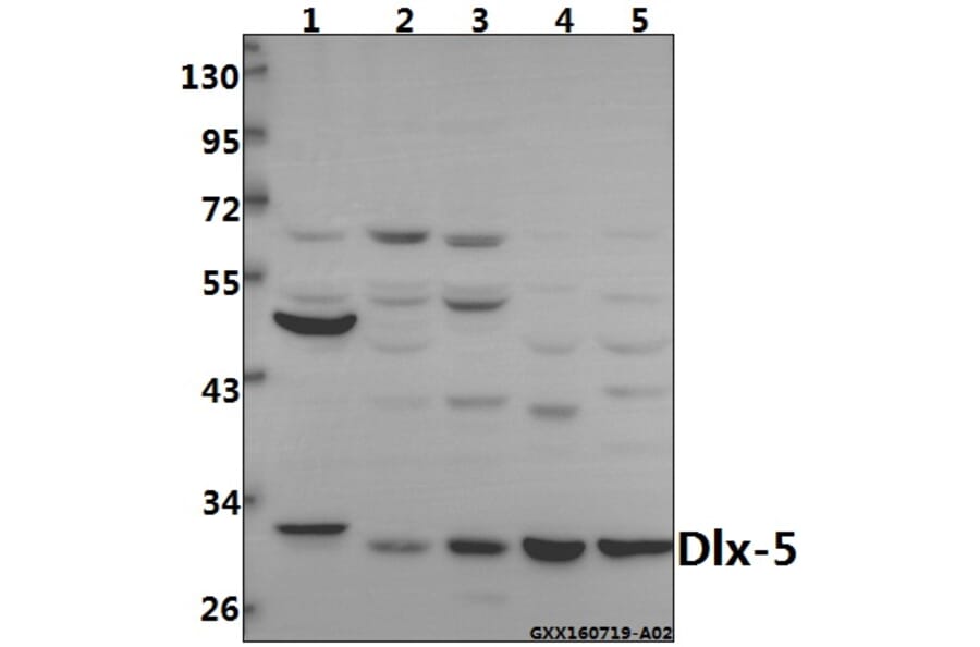 Anti-Dlx-5 (E126) Antibody from Bioworld Technology (BS2022) - Antibodies.com