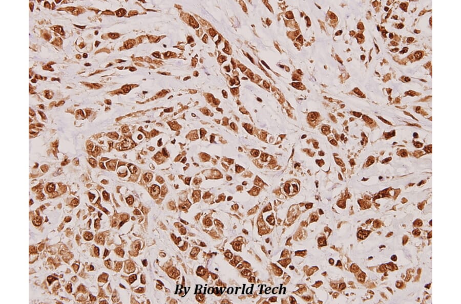 Anti-Dlx-5 (E126) Antibody from Bioworld Technology (BS2022) - Antibodies.com