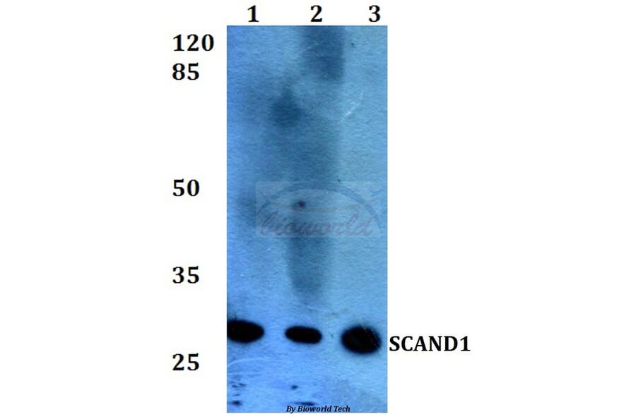 Anti-SCAND1 (E88) Antibody from Bioworld Technology (BS2023) - Antibodies.com