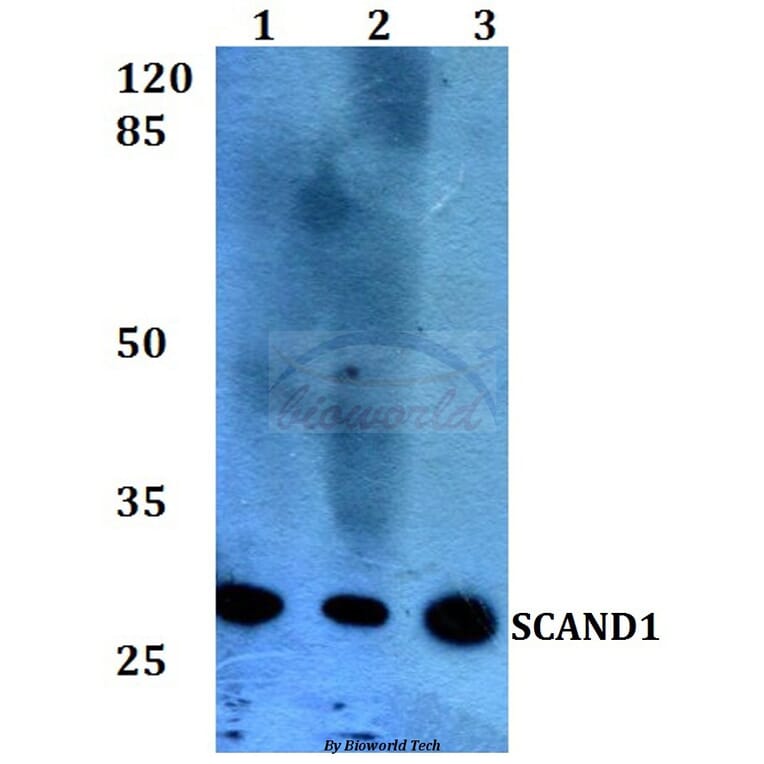 Anti-SCAND1 (E88) Antibody from Bioworld Technology (BS2023) - Antibodies.com