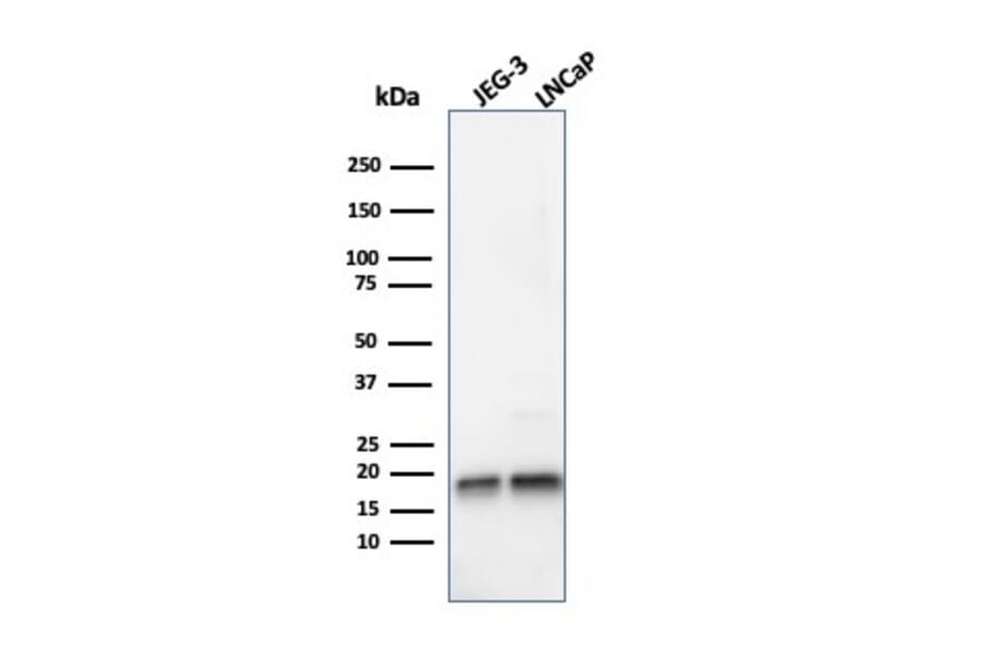 Western Blot - Anti-Superoxide Dismutase 1 Antibody [SOD1/4248] (A250000) - Antibodies.com