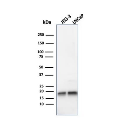 Western Blot - Anti-Superoxide Dismutase 1 Antibody [SOD1/4248] (A250000) - Antibodies.com