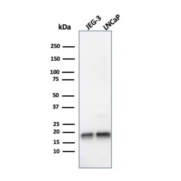 Western Blot - Anti-Superoxide Dismutase 1 Antibody [SOD1/4248] (A250000) - Antibodies.com