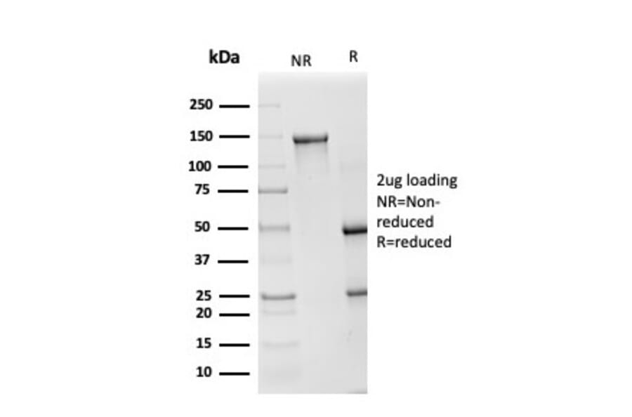 SDS-PAGE - Anti-Superoxide Dismutase 1 Antibody [SOD1/4248] (A250000) - Antibodies.com