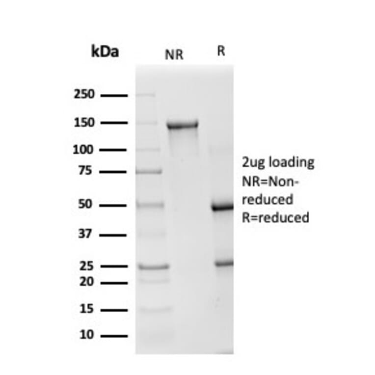 SDS-PAGE - Anti-Superoxide Dismutase 1 Antibody [SOD1/4248] (A250000) - Antibodies.com