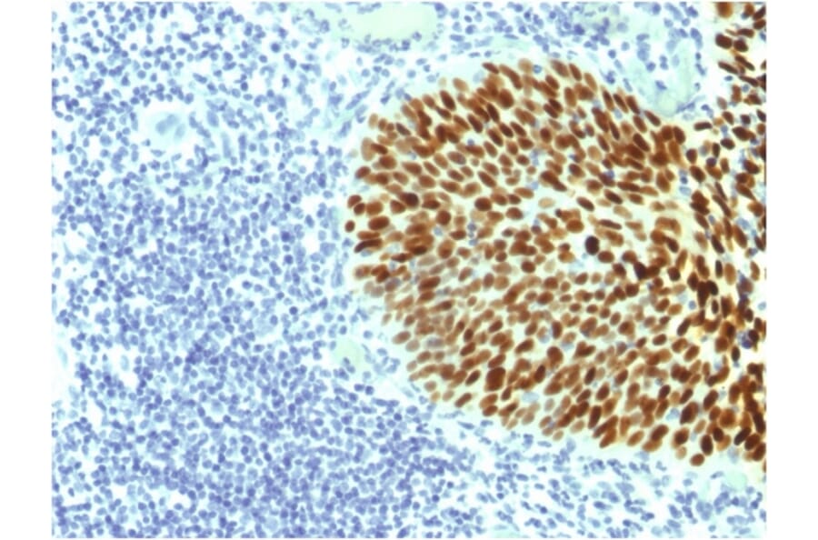 Immunohistochemistry - Anti-SOX2 Antibody [SOX2/1791] (A250002) - Antibodies.com