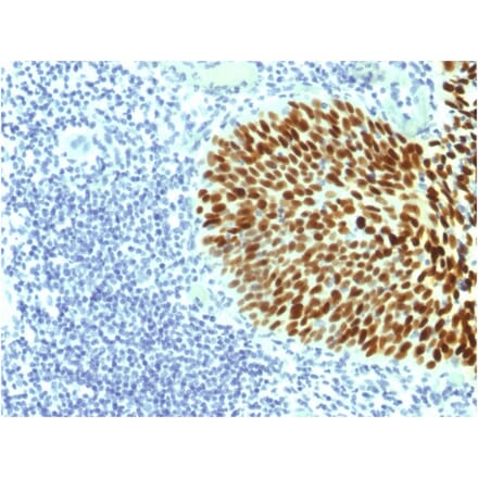 Immunohistochemistry - Anti-SOX2 Antibody [SOX2/1791] (A250002) - Antibodies.com