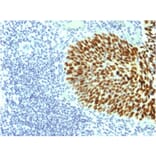 Immunohistochemistry - Anti-SOX2 Antibody [SOX2/1791] (A250002) - Antibodies.com